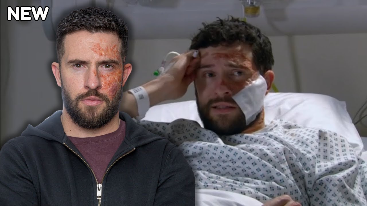 “Heartbreaking News: Emmerdale Star Michael Parr Opens Up About Ross Barton’s Shocking Return!”