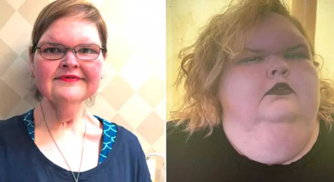 1000-lb Sisters star Tammy Slaton’s doctor speaks out after she surpasses goal weight with unbelievable transformation